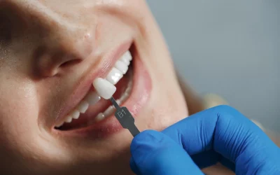 Dental Veneers VS Crowns: What’s The Difference And Which One Is Better?