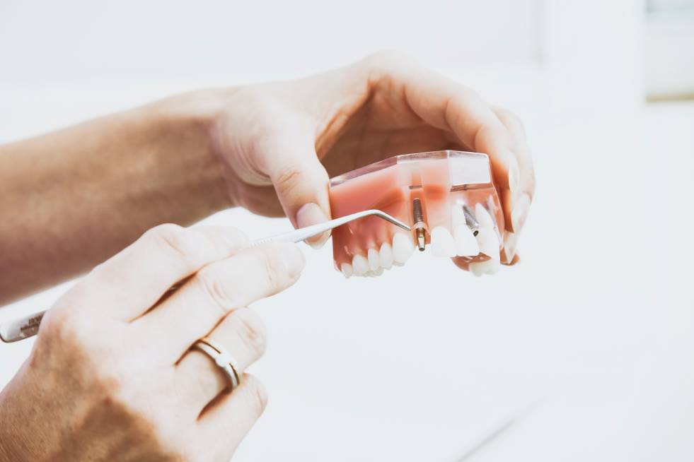 Dental Implant Treatment in India