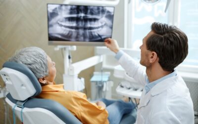 5 Types Of Dental X-Rays For Specific Dental Problems